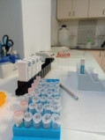 Testovanie a finalizácia vypurifikovaných protilátok 1, DB Biotech
